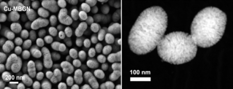 Towards entry "Bioactive glasses are able to heal infected bone defects and chronic skin wounds"